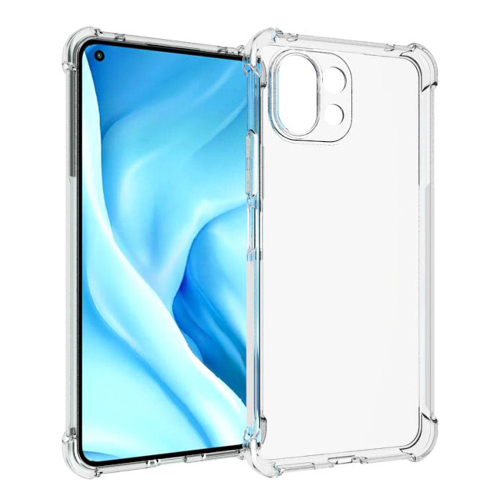 Schutzhülle + 2x Glas + Kameraschutz Bizon Case Clear Pack für Xiaomi Mi 11 Lite / 5G / 5G NE, Transparent