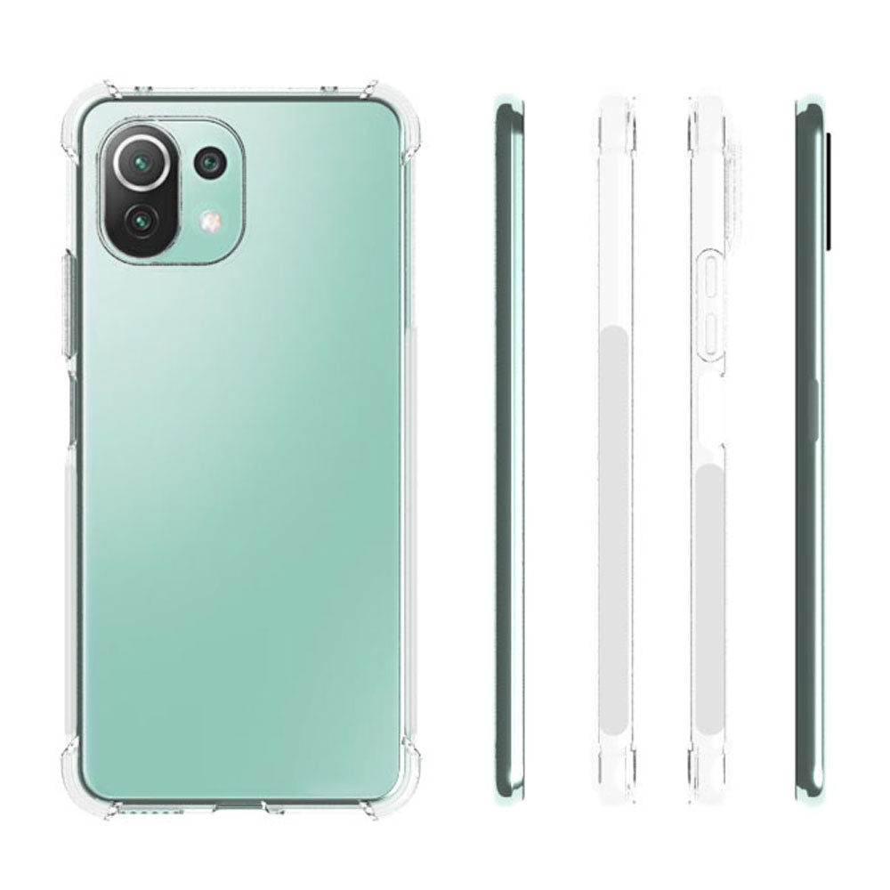 Schutzhülle + 2x Glas + Kameraschutz Bizon Case Clear Pack für Xiaomi Mi 11 Lite / 5G / 5G NE, Transparent